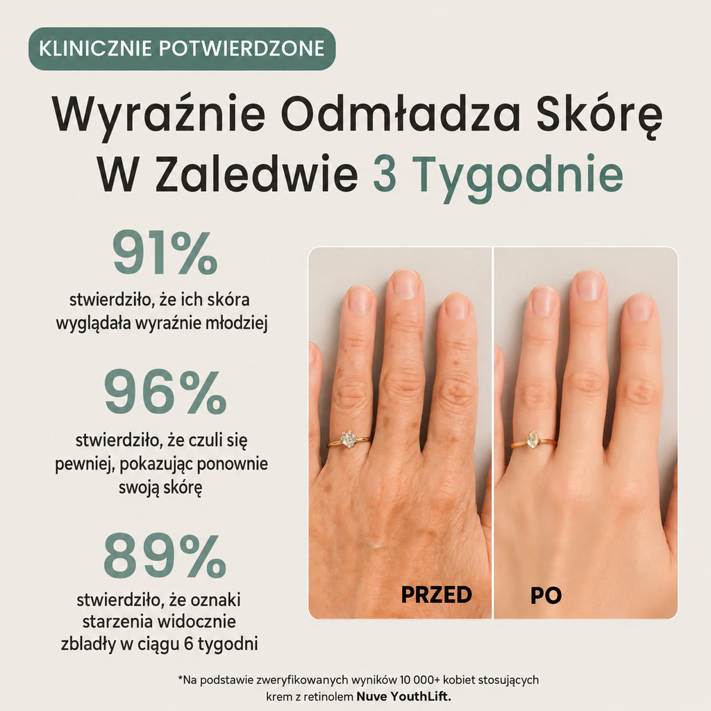 „Nuve YouthLift Retinol“ odos kremas
